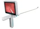 Endosee Advance - Direct Visualization System for Diagnostic and Therapeutic Procedures