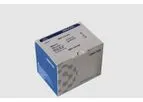 Del-HBA-T Test Kit