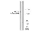 Model pTyr1349 - Anti-c-Met Antibody