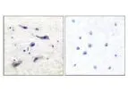 Model pSer2448 - Anti-mTOR Antibody