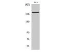 Model pTyr877 - Anti-HER2 Antibody
