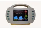 Model NM-M100 - ETCO2/SPO2 Monitor