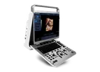 Xray4Vets - Model EBit30 - Ultrasound Display Unit