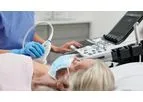 GE HealthCare - Model LOGIQ E10 Series - Ultrasound System for Dense Breast Tissue