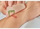 Grapheal WoundLAB - Electronic Wound Patch
