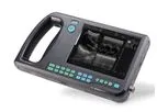 Shinova - Model SonoScan A1V - Palm Ultrasound System