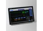 Schiller - Model DS20 - Diagnostic Station