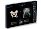 Smith-Nephew - Model RI.KNEE - Real Intelligence Knee Navigation System