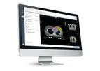 ePeerReview - Oncological Treatment Planning Software