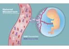 YourgeneHealth Sage - Non-invasive Prenatal Screen
