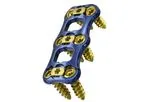 Admiral - Model ACP - Anterior Cervical Plating System