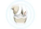 Hyalex - Human Cartilage Restoring