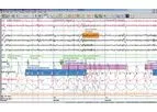 Natus SleepWorks - PSG Software
