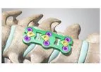 Cetra - Anterior Cervical Plate System
