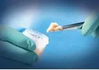 Trinity Evolution - Allograft with Viable Cells
