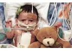 PolyVascular - Polymeric Transcatheter Valves for Children
