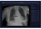 Arterys - Version | MSK AI - Emergency Department Chest X-ray Software