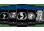 Version Viz Aortic - AI-Powered Aortic Disease Detection