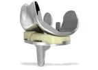 Conformis - Model iPoly & iPoly XE - Inserts & Bearings