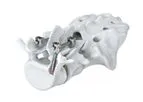 ATEC Arsenal - Cortical Bone Fixation System