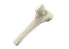 RTI - Structural Allografts