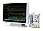 Patient Monitoring Systems