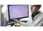 Indivumed - Biomarker Discovery and Validation Services