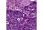 Virasoft - Mitosis Analysis Technology