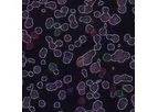 Fluorescent - Fluorescent in Situ Hybridization Technology