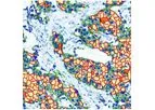 Virasoft - Model HER2 - Epidermal Growth Factor Receptor 2