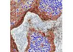 Virasoft - Model PD-L1 - Programmed Cell Death Protein
