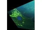 Gain - Model See-Tx - Site-Directed Enzyme Enhancement Therapy (See-Tx) Platform