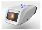 RetinaVue - Model 700 - Retinal Imager
