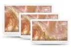 Scivita - Medical 4K LCD Monitor