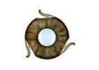 Ophtec - Iris Prostheses