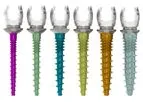 Medicrea - Model PASS TULIP Prime - Thoracolumbar Fixation System