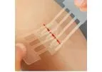Clozex - Model 3 - Emergency Laceration Closures