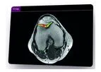 Olea Sphere - Version 3.0 - Groundbreaking MSK Imaging Software