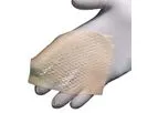 MiroDerm - Biologic Wound Matrix