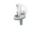 GEMINI - Model SL - Total Knee Replacement System