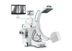 Orthoscan - Model Ziehm Solo FD - Compact C-arms