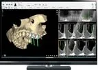 NemoScan - Solution for Diagnosis and Planning of Implantology Treatments