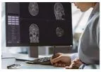 Med-DeepBrain - Supporting Tool for Diagnosis
