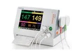 Sonicaid - Model Team3 Series - Fetal/Maternal Monitor