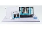 Swissray - Model ddRAura™ DRive - Analog to Digital Upgrade Kit