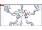 RAPID Aneurysm - Comprehensive Aneurysm Management Software