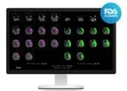 RapidAI - MRI Diffusion and Perfusion Image Analysis Software