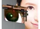 Navilas - Anterior Segment Mode Laser Trabeculoplasty and Laser Peripheral Iridotomy Software