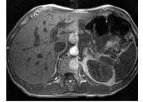 Orviglance - MR-Imaging of the Liver