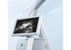 Zeiss Infrared - Model 800 - Fluorescence-Based Video Angiography